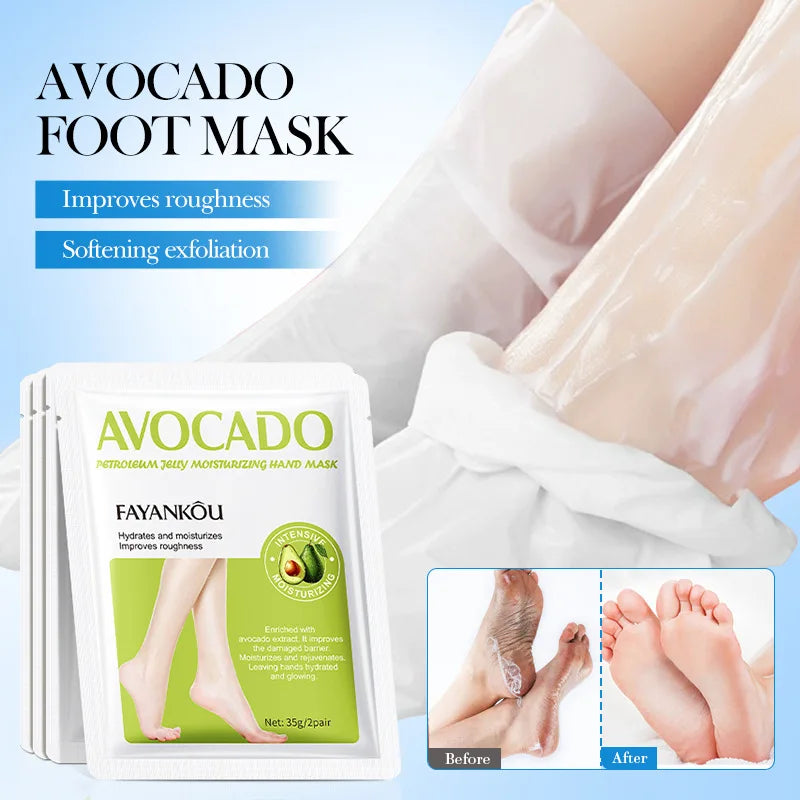 5 Paar Avocado-Peeling-Fußmasken für die Fußpflege – Entfernt abgestorbene Hautschüppchen – Feuchtigkeitsspendende Fußpeeling-Masken – Hautpflegeprodukte