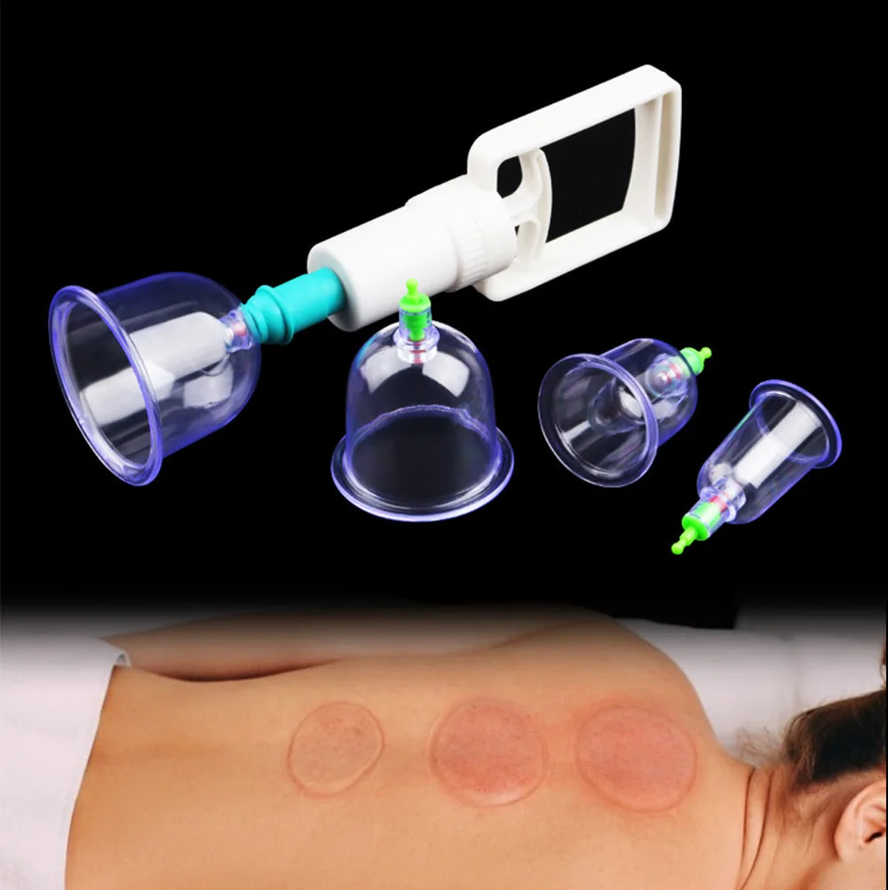 6 Saugnäpfe für Rücken-Vakuum-Schröpfmassage-Set mit Pumppistole für Körpermassage gegen Cellulite