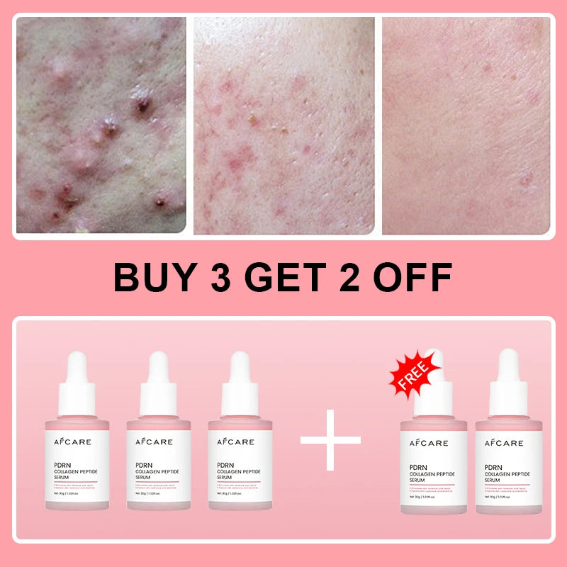 Collagen Peptide Renewal Serum