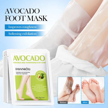 5 Paar Avocado-Peeling-Fußmasken für die Fußpflege – Entfernt abgestorbene Hautschüppchen – Feuchtigkeitsspendende Fußpeeling-Masken – Hautpflegeprodukte