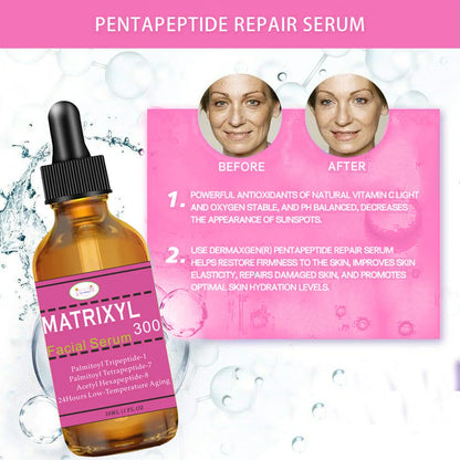 Matrixyl Hyaluronic Vitamin C Serum