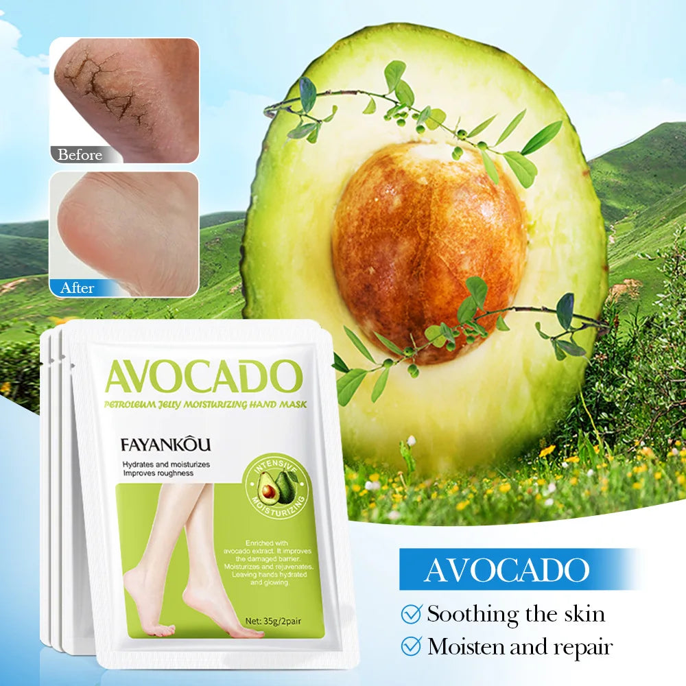 5 Paar Avocado-Peeling-Fußmasken für die Fußpflege – Entfernt abgestorbene Hautschüppchen – Feuchtigkeitsspendende Fußpeeling-Masken – Hautpflegeprodukte