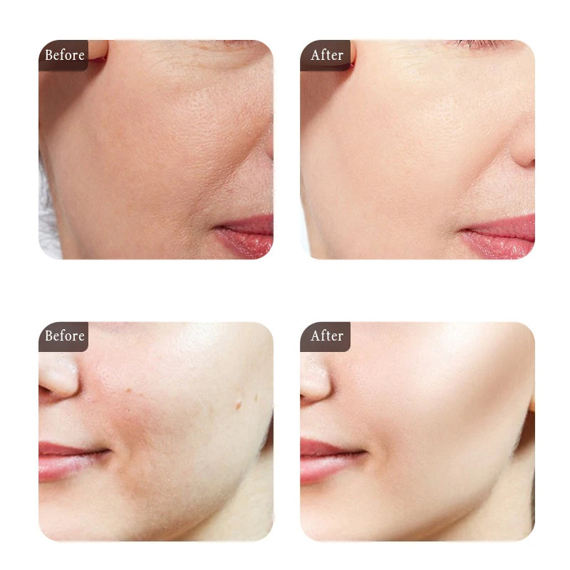 Caviar Collagen Eye &amp;amp; Face