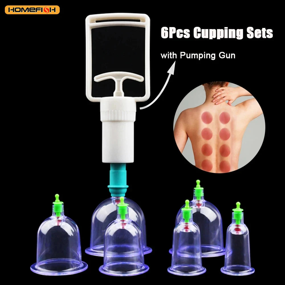 6 Saugnäpfe für Rücken-Vakuum-Schröpfmassage-Set mit Pumppistole für Körpermassage gegen Cellulite