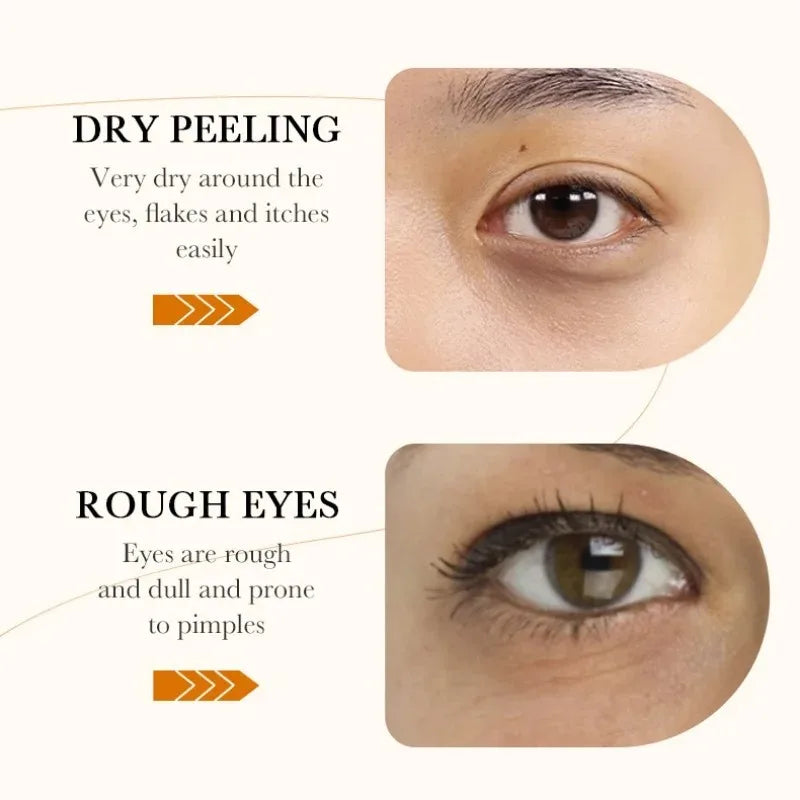 Bioaqua Rice Eye Masks