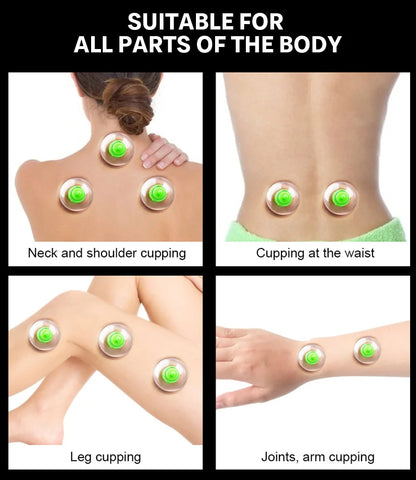 6 Saugnäpfe für Rücken-Vakuum-Schröpfmassage-Set mit Pumppistole für Körpermassage gegen Cellulite