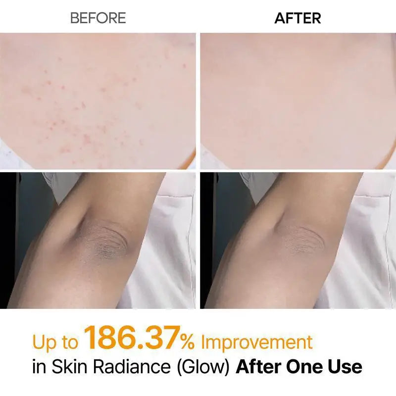 Kojic-Kurkuma-Körperspray