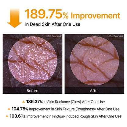 Kojic-Kurkuma-Körperspray