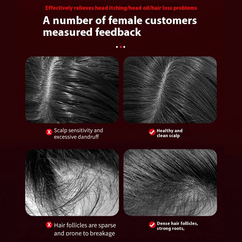 Electric Scalp Massage Comb