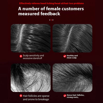 Electric Scalp Massage Comb
