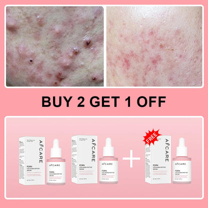 Collagen Peptide Renewal Serum