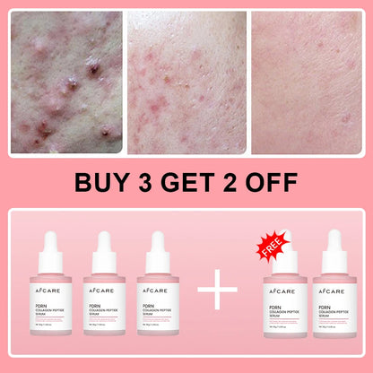 Collagen Peptide Renewal Serum